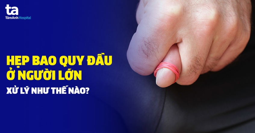 Bao quy đầu bị viêm là gì? Làm sao để biết bao quy đầu bị viêm? 5