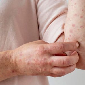 Bệnh Lậu Lây Từ Mẹ Sang Con Như Thế Nào? 2