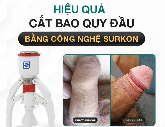 25 Tuổi Cắt Bao Quy Đầu Được Không? Khi Nào Nên Cắt BQĐ? 1