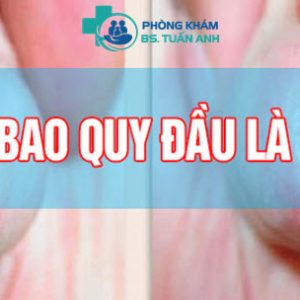 Bao Quy Đầu Dính Vào Dương Vật Là Bị Bệnh Gì? Nên Xử Lý Thế Nào? 1