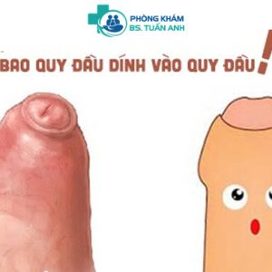 Cắt Bao Quy Đầu Có Tăng Thời Gian Quan Hệ Không? Khi Nào Nên Cắt BQĐ? 3